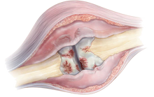 Load image into Gallery viewer, Hydroxyapatite Nano 60 Food Grade 100 % Pure, BONE & TEETH HEALTH- US SELLER!!!!