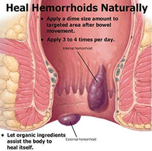 Load image into Gallery viewer, Hemorrhoid & Piles Ointment, Salve/Balm, Treatment, Anal Fissure, Pain, Swelling
