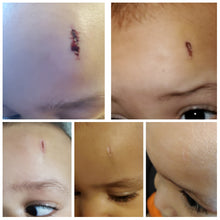 Load image into Gallery viewer, Baby Balm/Salve Diaper Rash, Cradle Cap, Dry Skin, Bug Bites, Cuts