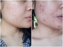 Load image into Gallery viewer, Turmeric Oil, Vitamin C, Cold Pressed, Organic, Anti-inflammatory, Hyperpigmentation, 2 oz