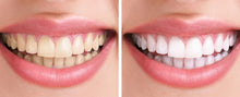 Load image into Gallery viewer, Hydroxyapatite Nano 60 Food Grade 100 % Pure, BONE & TEETH HEALTH- US SELLER!!!!