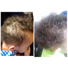 Load image into Gallery viewer, Hair Growth Oil InfinityDHT, Alopecia, Thinning Hair, Balding, Organic
